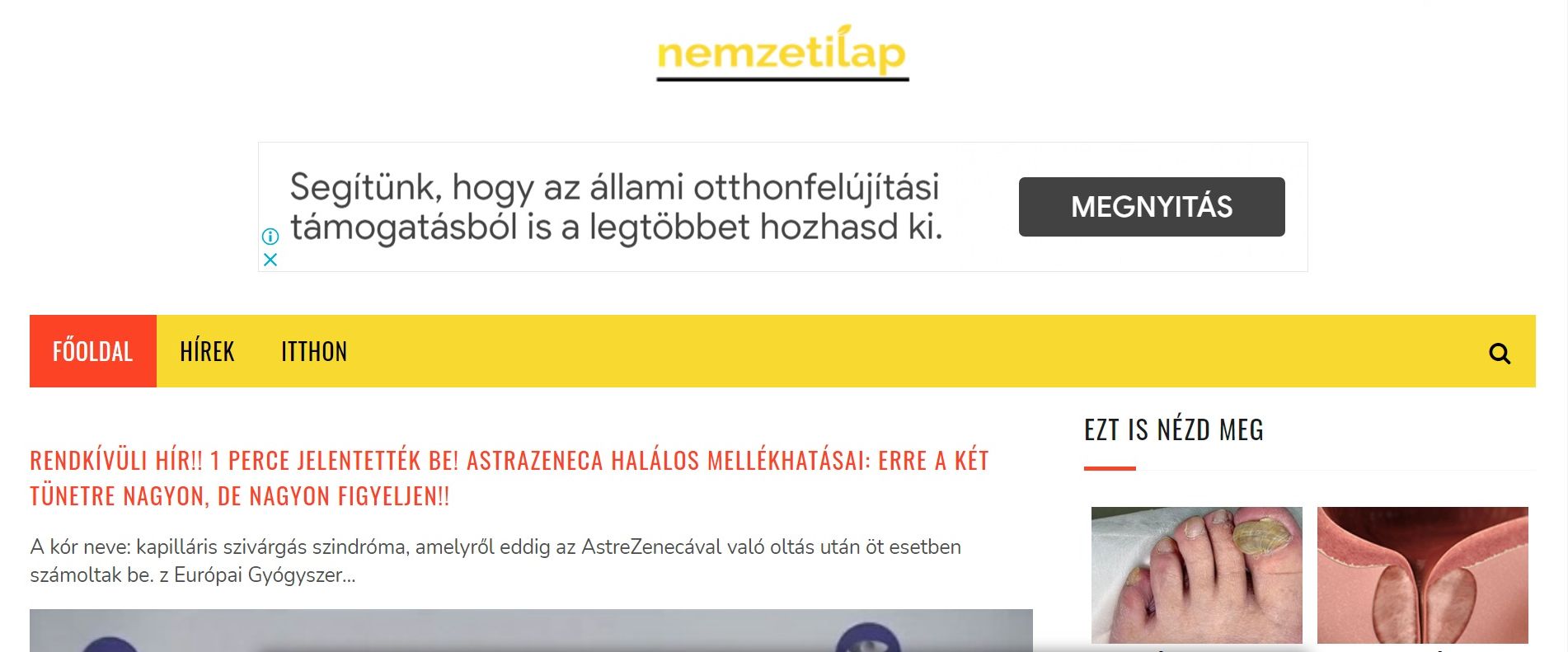Szele Tamás: Sajtóparaziták